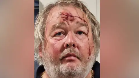 Masked gunmen and poisoned gravy – how my wife plotted to kill me