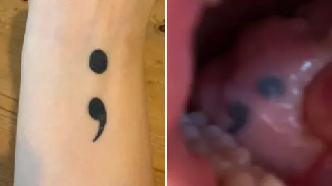 The tattoo on my arm is now on my tongue after cancer treatment