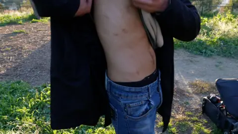 The Immortal lifts his shirt to show bullet wounds on his torso