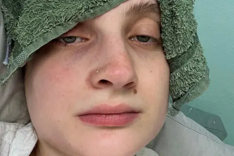 I lost 3st and was sick 40 times a day during pregnancy