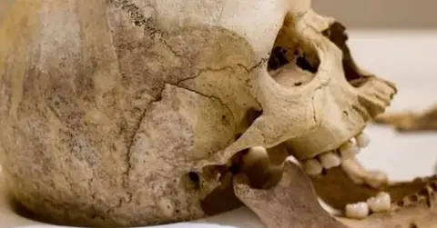 Graham Huntley A skull.